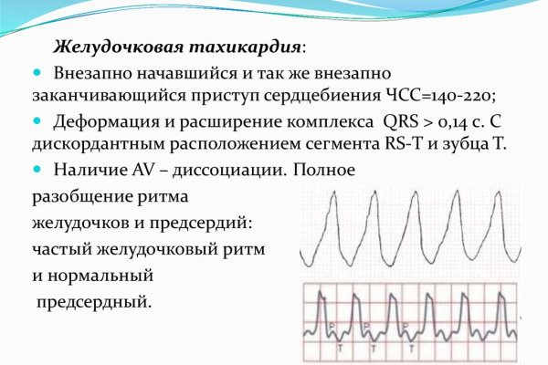 Как зарегистрироваться на сайте кракен